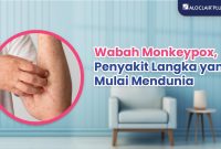 Penyakit Langka Yang Belum Banyak Diketahui