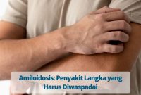 Amiloidosis: Penyakit Langka yang Harus Diwaspadai