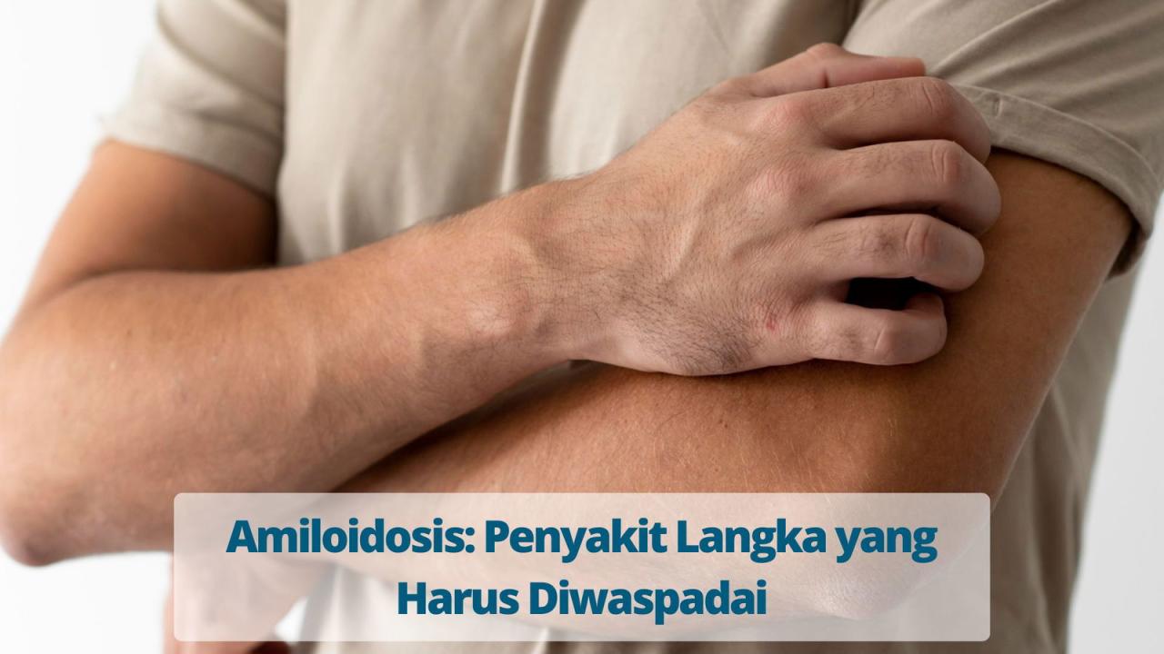 Amiloidosis: Penyakit Langka yang Harus Diwaspadai